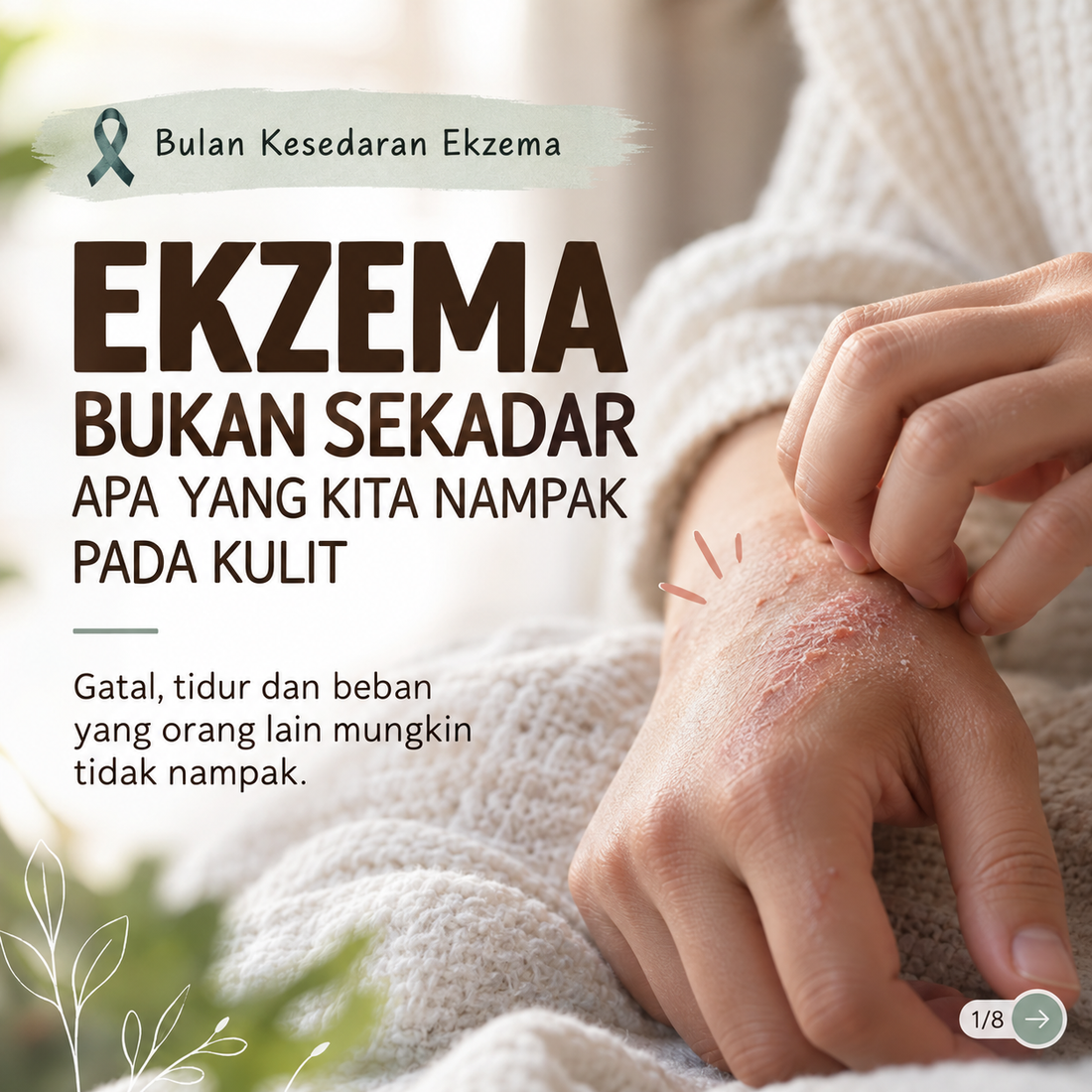 Ekzema Bukan Sekadar Apa yang Kita Nampak pada Kulit